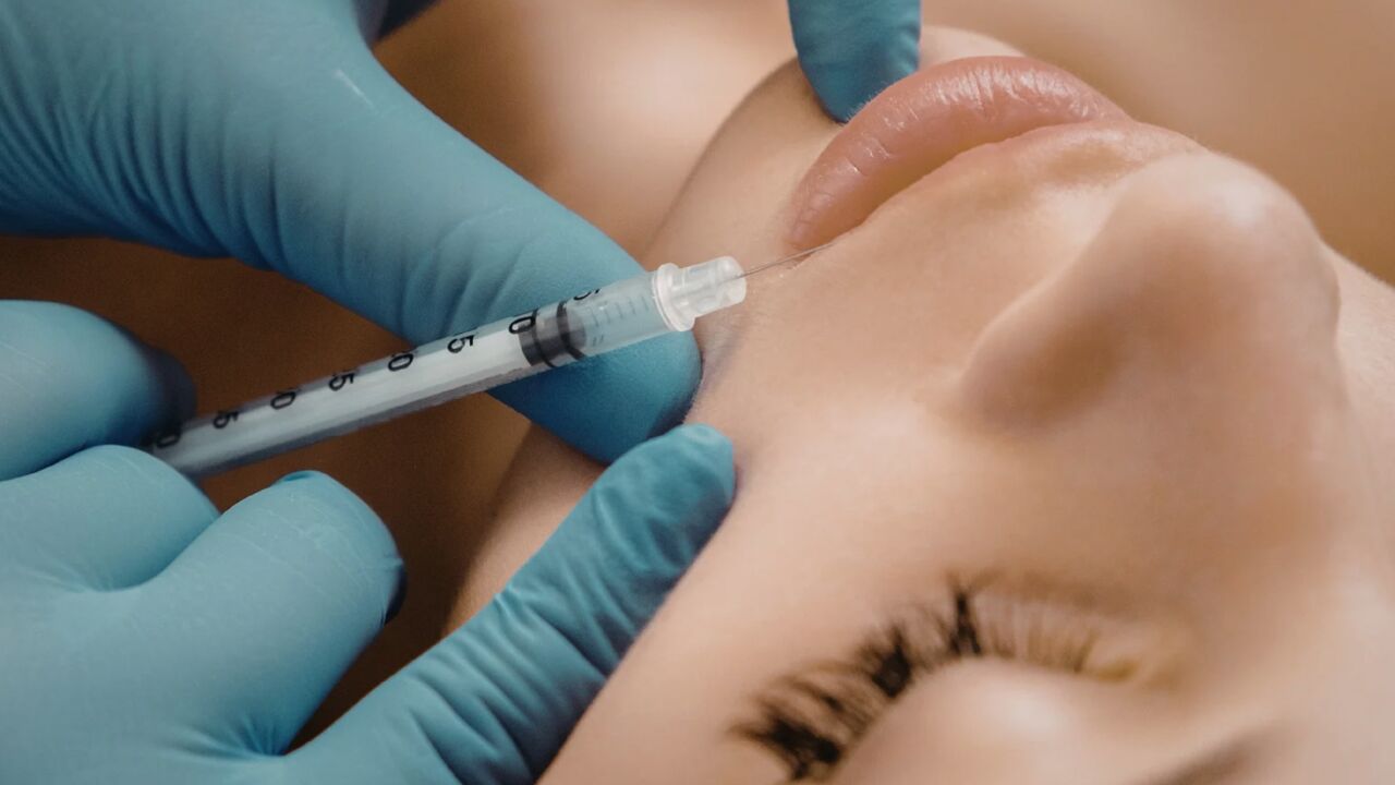 Dermal Fillers